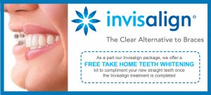clear braces alternative