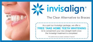 braces alternative