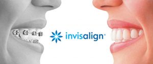 invisalign logo