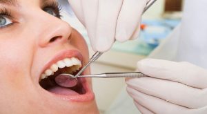 Dental Implants