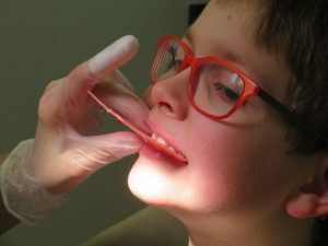 dental care for children